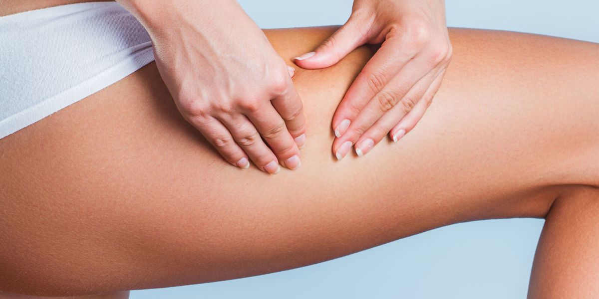 tratamiento de celulitis con mesoterapia