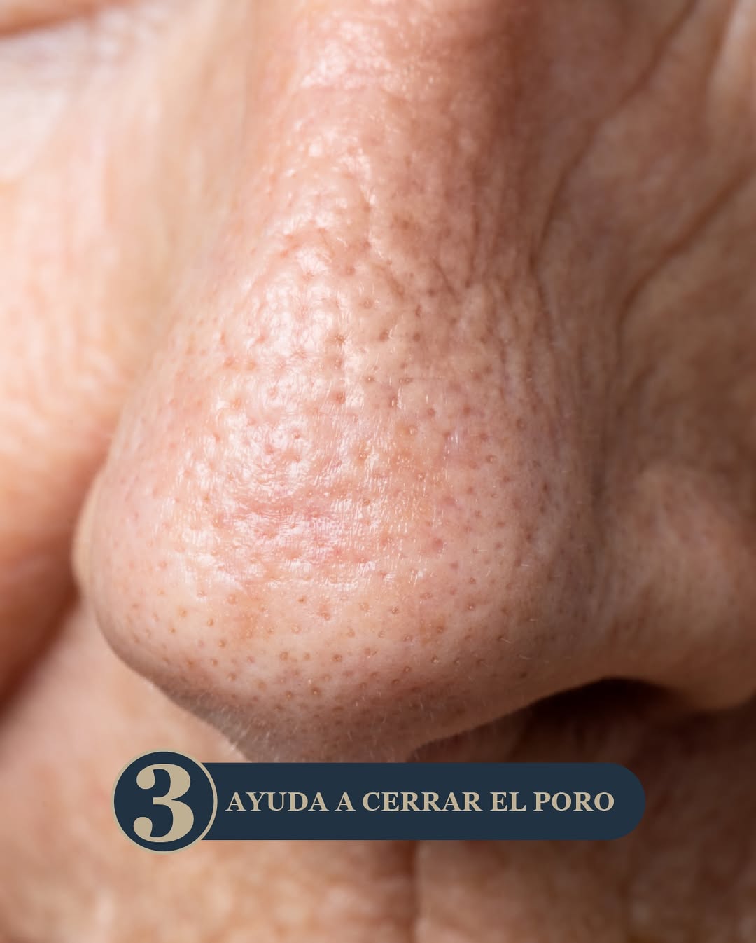 Peeling Quimico Facial